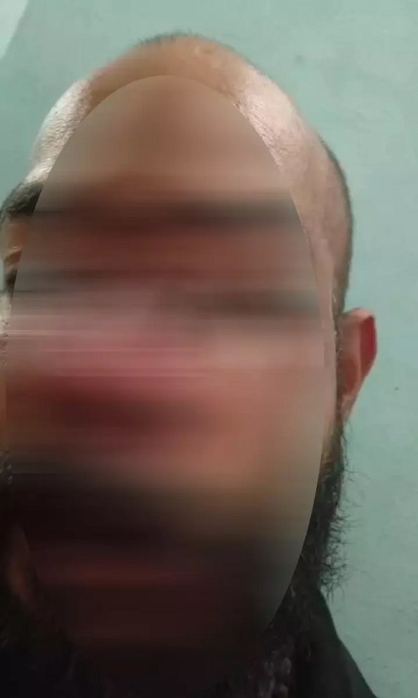 CG CRIME : दुर्ग-भिलाई के बदमाशों ने बार में मचाया उत्पात, पिस्टल के बट्टे से कारोबारी का चेहरा कुचला