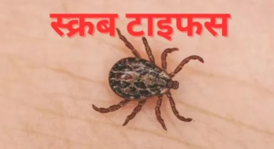 स्वाइन फ्लू के बाद अब ‘स्क्रब टाइफस’ का खौफ: जांजगीर के 25 वर्षीय युवक की मौत, महीनेभर में 45 केस; इधर ओडिशा के सुंदरगढ़ में मेडिकल टीम तैनात